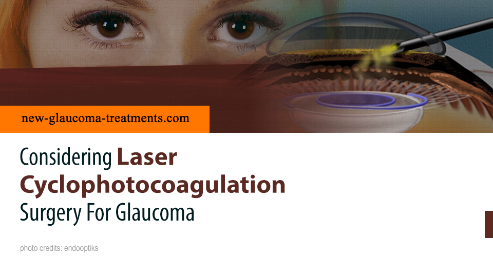 Considering Laser Cyclophotocoagulation