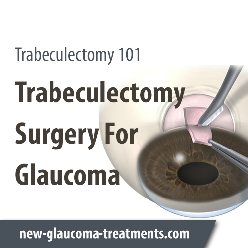 Trabeculectomy Surgery For Glaucoma