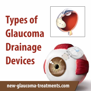 Types of Glaucoma Drainage Devices