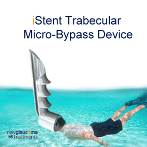iStent-Trabecular-Micro-Bypass-Device