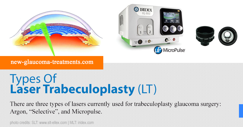 Types Of Laser Trabeculoplasty