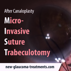 Micro-invasive Suture Trabeculotomy (MIST) After Canaloplasty