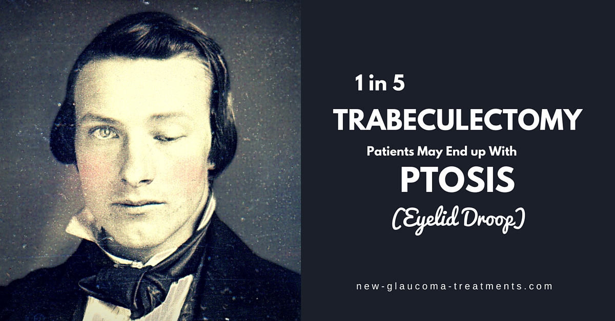 1 in 5 Trabeculectomy Patients May End up With Ptosis (Eyelid Droop)