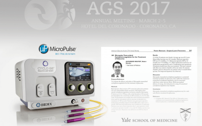 One-Year Results of Micropulse Trans-scleral Cyclophotocoagulation – Yale Study